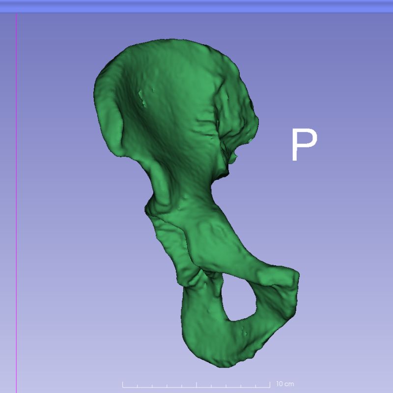 Segmentación DICOM en 3D Slicer — Hefestech